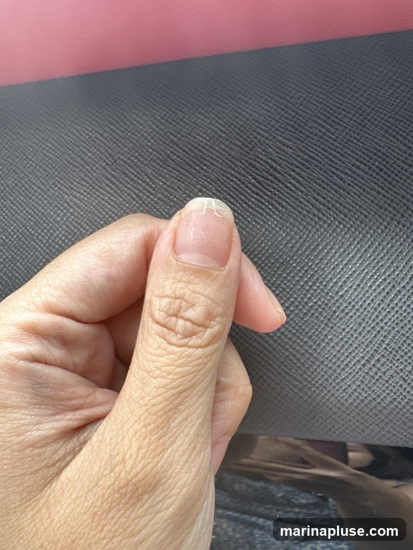 A close-up shot focuses on a person's thumb and index finger, with a chipped fingernail prominently displayed on the index finger. The background consists of a textured dark gray surface and a blurred pink area above it.