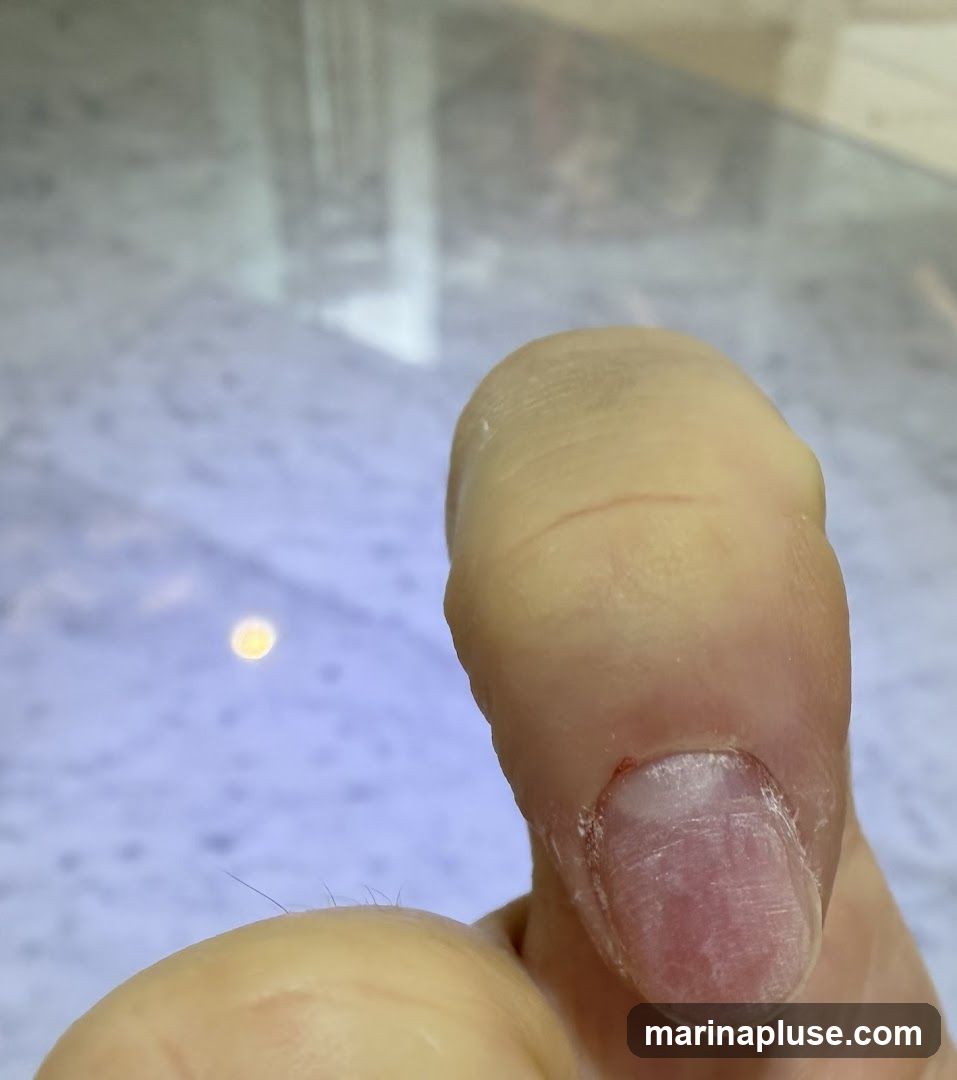 A close-up, macro photograph focuses on a person's thumb. The thumb appears to have a blister forming on the tip, with a slightly raised, yellowish area. The nail bed is visible, showing a somewhat rough and unkempt nail. Fine hairs are also visible on the skin of the thumb. The background is blurred and appears to be a reflective surface with a soft, out-of-focus light source.
